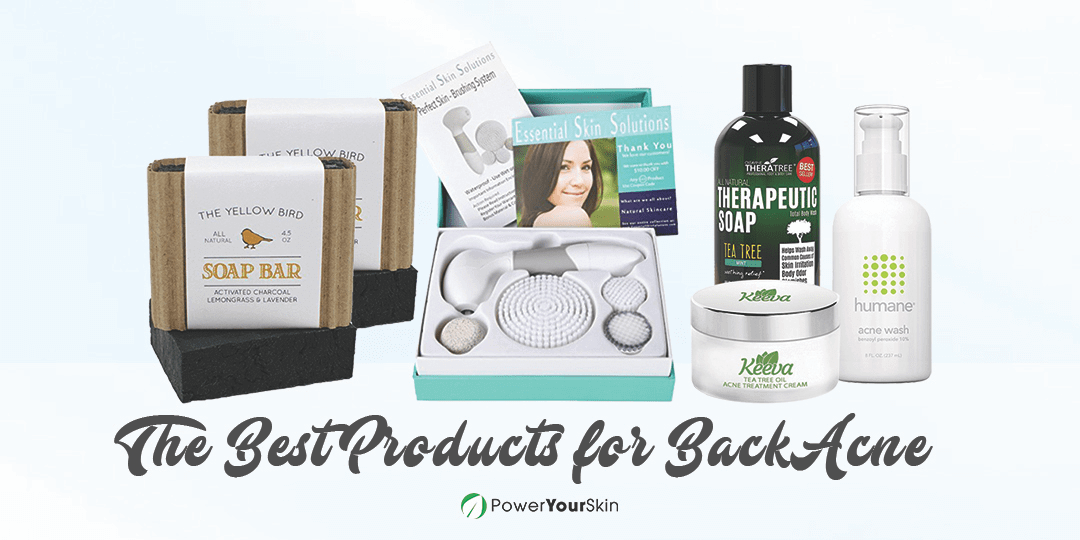 Best Products for Back Acne