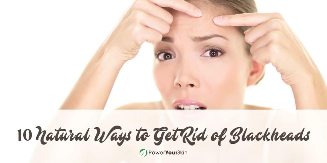 10 Natural Ways to Get Rid of Blackheads