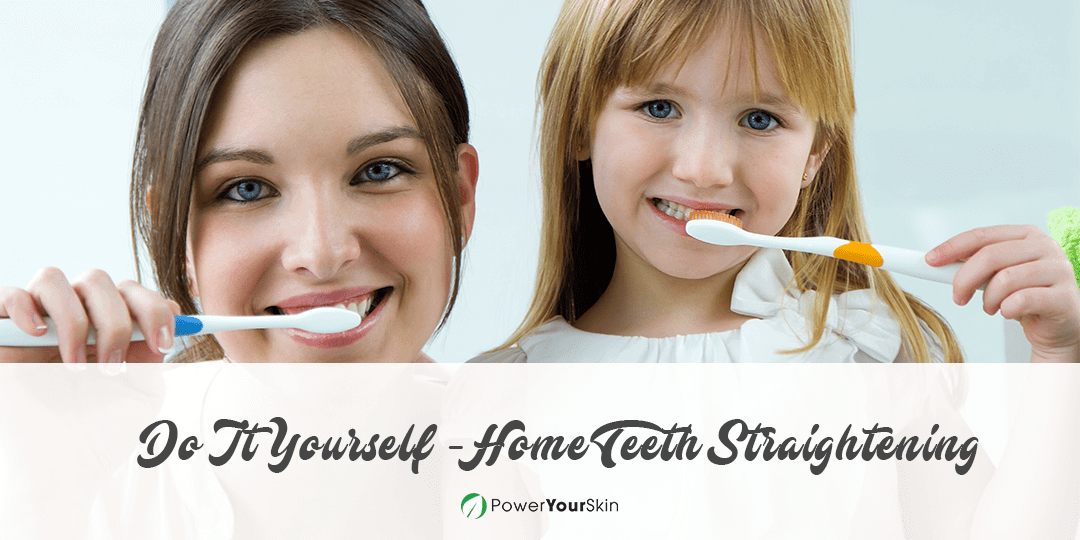 DIY at Home Teeth Straightening
