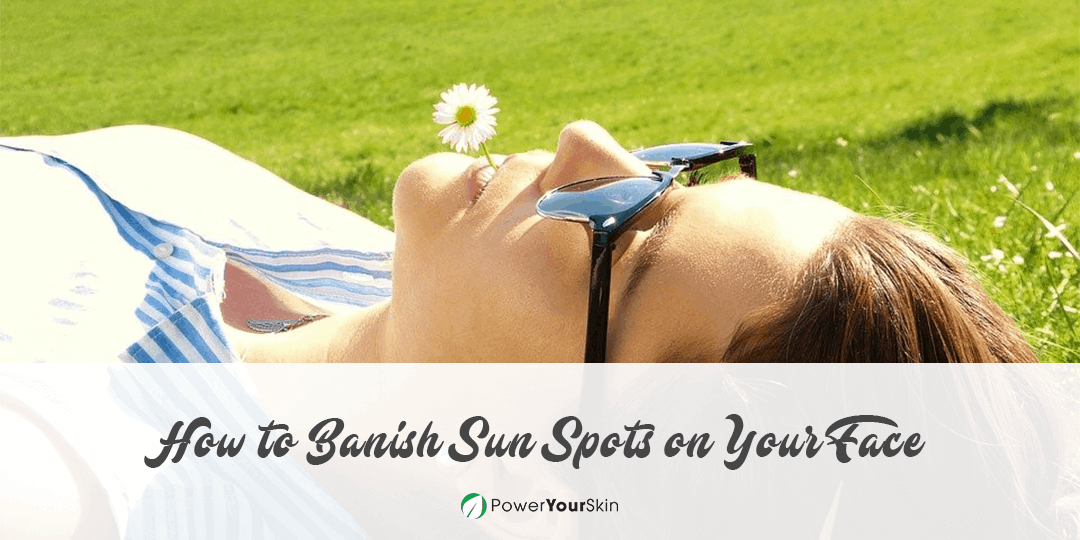 How to Banish Sun Spots on Your Face